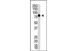 Image no. 1 for anti-Protein Inhibitor of Activated STAT, 4 (PIAS4) (C-Term) antibody (ABIN356771) (PIAS4 anticorps  (C-Term))