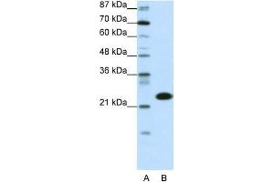 Transfected 293T; WB Suggested Anti-TAF11 Antibody Titration: 0. (TAF11 anticorps  (N-Term))