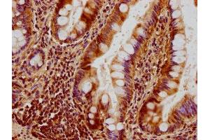 IHC image of ABIN7150845 diluted at 1:300 and staining in paraffin-embedded human small intestine tissue performed on a Leica BondTM system.