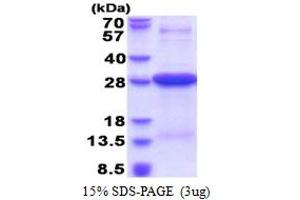 SDS-PAGE (SDS) image for HLA Class II DR alpha (HLA-DRA) (AA 26-216) protein (His tag) (ABIN5853581)