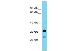 Host: Rabbit Target Name: HSD17B13 Sample Type: Fetal Brain lysates Antibody Dilution: 1. (HSD17B13 anticorps  (N-Term))