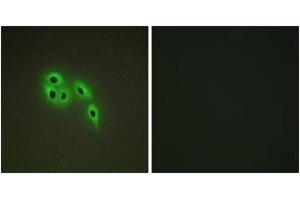 Immunofluorescence analysis of A549 cells, using DOK6 Antibody. (DOK6 anticorps  (AA 111-160))