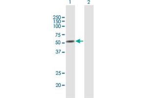 Western Blot analysis of ANXA11 expression in transfected 293T cell line by ANXA11 MaxPab polyclonal antibody.