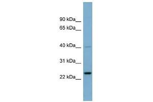 HSPC111 antibody used at 1 ug/ml to detect target protein. (NOP16 anticorps  (Middle Region))
