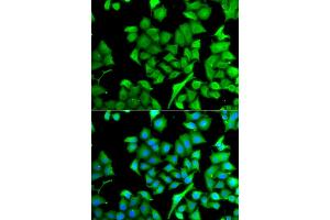 Immunofluorescence analysis of A549 cells using NAA50 antibody (ABIN5975518).
