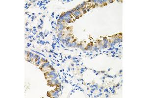 Immunohistochemistry of paraffin-embedded mouse lung using IRAK2 antibody (ABIN5971467) at dilution of 1/100 (40x lens). (IRAK2 anticorps)