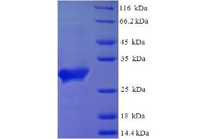 SDS-PAGE (SDS) image for Saitohin (STH) (AA 1-128), (full length) protein (His-SUMO Tag) (ABIN5710424)