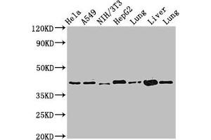 Western Blot Positive WB detected in: Hela whole cell lysate, A549 whole cell lysate, NIH/3T3 whole cell lysate, HepG2 whole cell lysate, Rat lung tissue, Mouse liver tissue, Mouse lung tissue All lanes: ACAA2 antibody at 2.