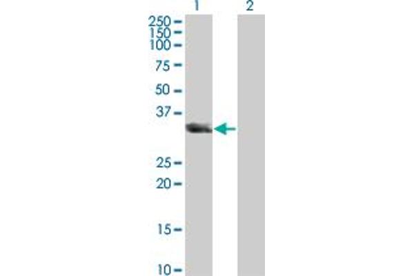 UNC119 Antikörper  (AA 1-240)