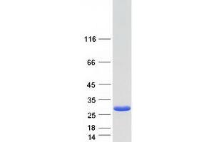 Validation with Western Blot