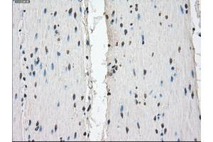 Image no. 8 for anti-Fc gamma RII (CD32) antibody (ABIN1497254) (Fc gamma RII (CD32) anticorps)