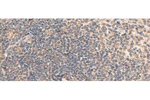 Immunohistochemistry of paraffin-embedded Human tonsil tissue using RPL13A Polyclonal Antibody at dilution of 1:95(x200)