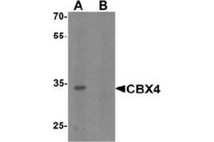 Western blot analysis of CBX4 in human brain tissue lysate with CBX4 Antibody  at 1 μg/ml in (A) the absence and (B) the presence of blocking peptide. (CBX4 anticorps  (N-Term))