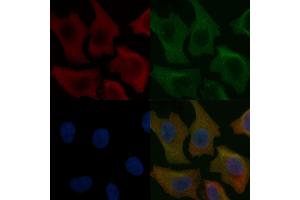 GUCA1A Mouse Monoclonal Antibody staining Hela cells by IF/ICC. (GCAP1 anticorps)