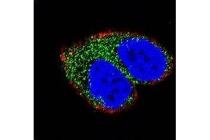 Confocal immunofluorescent analysis of AIM2 antibody with MCF-7 cells followed by Alexa Fluor 488-conjugated goat anti-rabbit lgG (green).