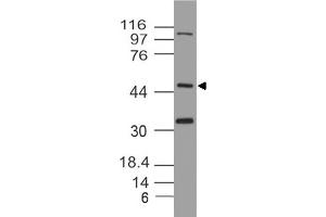 Image no. 1 for anti-Thioredoxin Interacting Protein (TXNIP) (AA 50-300) antibody (ABIN5027615) (TXNIP anticorps  (AA 50-300))