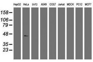 Image no. 3 for anti-Chromobox Homolog 8 (CBX8) (AA 1-260) antibody (ABIN1490661) (CBX8 anticorps  (AA 1-260))