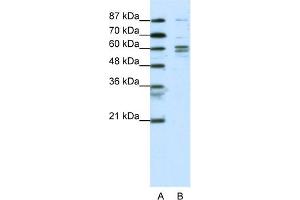 WB Suggested Anti-GTF2F1 Antibody Titration:  0.
