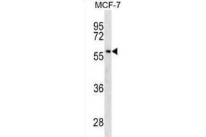 Western Blotting (WB) image for anti-Gc antibody (ABIN2930430) (Gc anticorps)