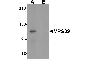 Western Blotting (WB) image for anti-Vacuolar Protein Sorting 39 Homolog (VPS39) (C-Term) antibody (ABIN1030796) (VPS39 anticorps  (C-Term))