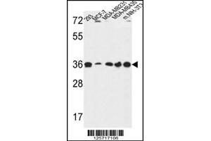 Western blot analysis in 293,MCF-7,MDA-MB231,MDA-MB435,and mouse NIH-3T3 cell line lysates (35ug/lane).
