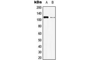 Western blot analysis of BMPR2 expression in HEK293T (A), Raw264. (BMPR2 anticorps  (N-Term))