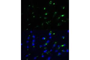Immunofluorescence analysis of NIH-3T3 cells using ENO1 antibody (ABIN3021299, ABIN3021300, ABIN3021301, ABIN1512865 and ABIN6214545) at dilution of 1:100.