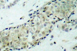 Image no. 1 for anti-Histone Deacetylase 5 (HDAC5) antibody (ABIN265457) (HDAC5 anticorps)