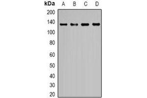 Western blot analysis of EGF expression in K562 (A), Hela (B), HEK293T (C), NIH3T3 (D) whole cell lysates. (EGF anticorps)