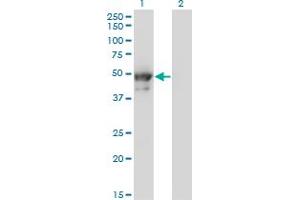 Western Blot analysis of KRT8 expression in transfected 293T cell line by KRT8 monoclonal antibody (M02), clone 3E3. (KRT8 anticorps  (AA 91-195))
