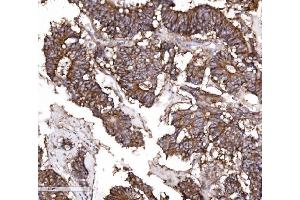 IHC analysis of Claudin 3/CLDN3 using anti-Claudin 3/CLDN3 antibody (ABIN7599626). (Claudin 3 anticorps  (AA 101-220))