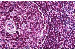 Human Spleen: Formalin-Fixed, Paraffin-Embedded (FFPE)