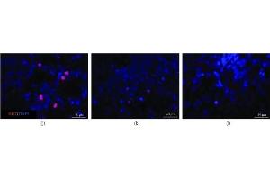 Immunofluorescence microscopy to examine the morphologies of cells from retinal organoids after exposure to immunosuppressants (a) Axons in the control group were long and strong and most expressed tubulin and NEFL (detected via immunofluorescence staining) indicating that the cells in this group could develop mature axons.