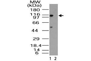 Western blot analysis of Importin-11 in HeLa lysate in the 1) absence and 2) presence of immunizing peptide. (Importin 11 anticorps  (AA 1-50))