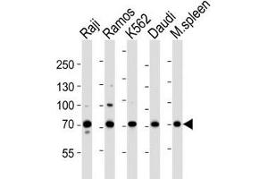 Western blot analysis of lysate from Raji, Ramos, K562, Daudi cell line and mouse spleen tissue lysate using BTK antibody at 1:1000.