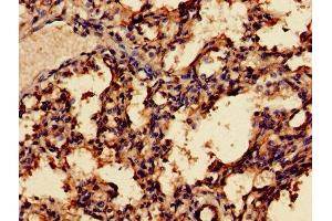 Immunohistochemistry of paraffin-embedded human lung tissue using ABIN7159273 at dilution of 1:100