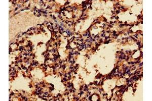 Immunohistochemistry of paraffin-embedded human lung tissue using ABIN7159273 at dilution of 1:100 (MAGEA8 anticorps  (AA 1-270))