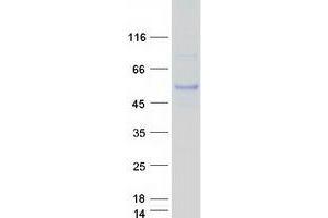 Validation with Western Blot