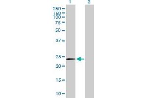Western Blot analysis of MYCL1 expression in transfected 293T cell line by MYCL1 MaxPab polyclonal antibody. (LMYC anticorps  (AA 1-206))