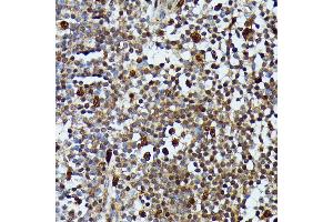 Immunohistochemistry of paraffin-embedded human appendix using MEKK3 antibody (ABIN7268652) at dilution of 1:100 (40x lens).