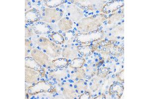 Immunohistochemistry of paraffin-embedded Rat kidney using R Rabbit pAb (ABIN6131585, ABIN6146704, ABIN6146705 and ABIN6222716) at dilution of 1:50 (40x lens). (Chemerin anticorps  (AA 17-163))