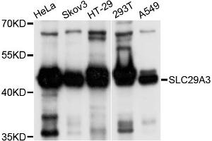 Western blot analysis of extracts of various cell lines, using SLC29A3 antibody (ABIN4905193) at 1:1000 dilution.