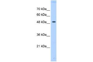 PTPN1 antibody used at 0. (PTPN1 anticorps  (Middle Region))