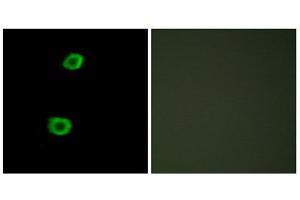 Immunofluorescence (IF) image for anti-Lemur tyrosine Kinase 2 (LMTK2) (Internal Region) antibody (ABIN1849763) (LMTK2 anticorps  (Internal Region))