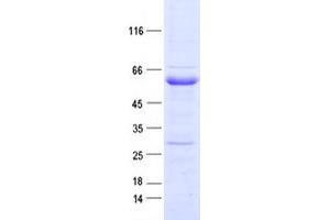 Validation with Western Blot