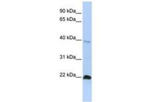 Image no. 1 for anti-NK3 Homeobox 2 (NKX3-2) (AA 251-300) antibody (ABIN6742350) (NKX3-2 anticorps  (AA 251-300))