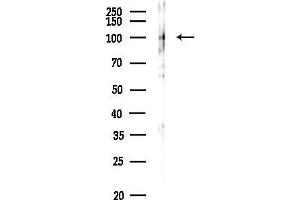 anti-Zinc Finger RNA Binding Protein (ZFR) antibody