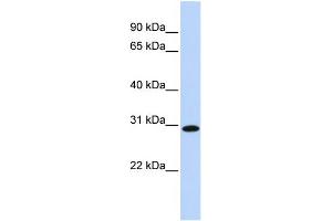 WB Suggested Anti-SMNDC1 Antibody Titration:  0.