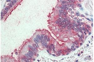 Anti-SLC44A2 antibody  ABIN1049339 IHC staining of human lung, respiratory epithelium. (SLC44A2 anticorps  (Internal Region))