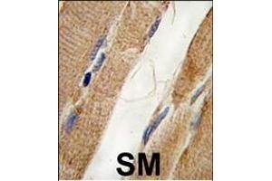 Formalin-fixed and paraffin-embedded human skeletal muscle tissue reacted with PI3KC3 Antibody , which was peroxidase-conjugated to the secondary antibody, followed by DAB staining.